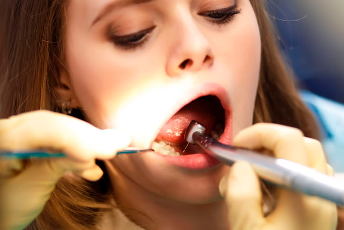 Endodoncias Algeciras